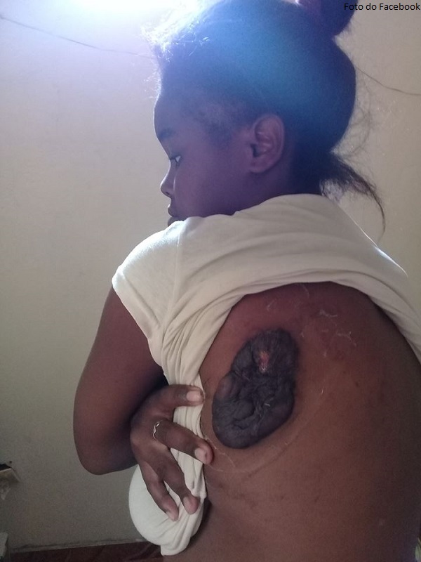 SÃO DOMINGOS: Jovem de Baía precisa de ajuda para se tratar fora de Cabo Verde