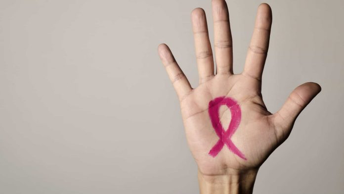 CANCRO DE MAMA