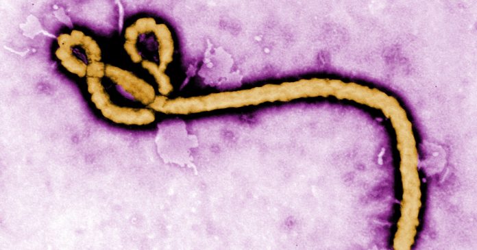 Ebola_virus_purple (1)