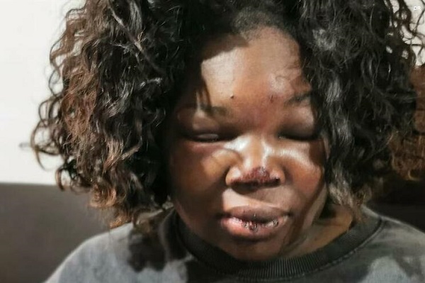 SOS Racismo exige suspensão de agente que terá agredido mulher na Amadora