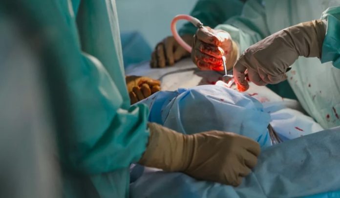 transplante-renal-1